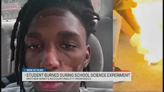 High school student burned during science experiment