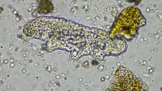 North Carolina teen dies from rare brain-eating amoeba found in freshwater