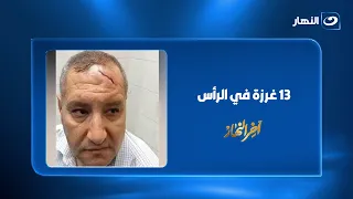 13 غرزة في الرأس.. ولي أمر يعتدي على مدير مدرسة بالدقهلية ونقابة المعلمين تتدخل