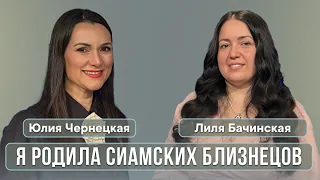 Я РОДИЛА СИАМСКИХ БЛИЗНЕЦОВ. Лиля Бачинская.