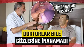 Went In for Surgery, Everything Inside Was in the Wrong Place | Even the Doctors Couldn't Believe...