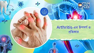 Arthritis এর উপসর্গ ও প্রতিকার। Health and Wellness