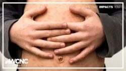 Falling measles vaccination rates could lead to outbreaks Falling measles vaccination rates could lead to outbreaks