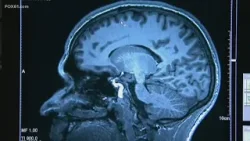 Keeping brain health in check