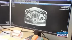 Patient #1 for non-surgical treatment for colorectal cancer