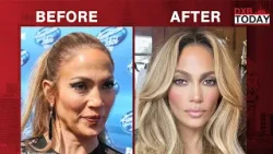 Jennifer Lopez's Plastic Surgery: Expert Insights from a Plastic Surgeon