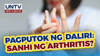 ALAMIN: Pagputok ng daliri, totoo bang sanhi ng arthritis?