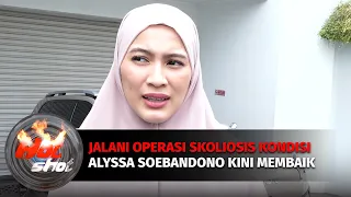 Cerita Alyssa Soebandono Jalani Operasi Skoliosis | Hot Shot