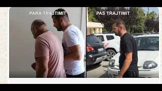 Tv Klan - Trajtimi me qeliza biologjike të sklerozës multiple