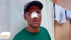 Hombre resulta herido tras agresión por haitiano en San Martín, SFM
