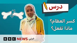 الإسعافات الأولية للكسور: ماذا تفعل عند حدوث كسر في العظم؟ | درس