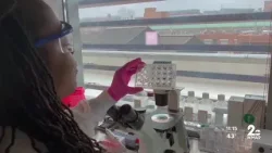 UMD professor grows lab fibroids to find better treatments UMD professor grows lab fibroids to find better treatments