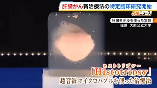New Liver Cancer Treatment Uses Shockwaves to Destroy Tumors Without Needles or Scalpels: Osaka M...