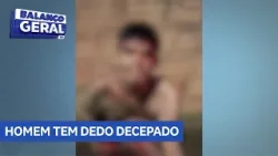Homem tem dedos decepados após tentar cometer furto pelaterceira vez