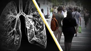 The effects of vaping and energy drinks: Popcorn lung and the risk of cardiac arrest