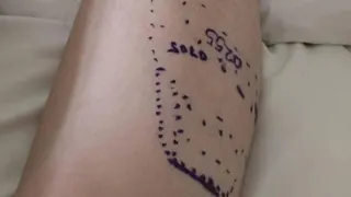 Arizona man released from hospital after rattlesnake bite