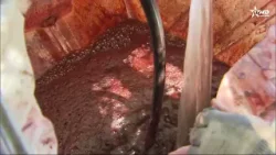 أي تأثير للموسم الاستثنائي من الأمطار والثلوج على مردودية الموسم ودينامية خلق فرص الشغل؟ أي تأثير للموسم الاستثنائي من الأمطار والثلوج على مردودية الموسم ودينامية خلق فرص الشغل؟