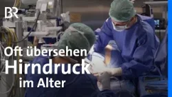 Altershirndruck erkennen: Probleme mit dem Gehen richtig deuten | Gesundheit! | BR Altershirndruck erkennen: Probleme mit dem Gehen richtig deuten | Gesundheit! | BR