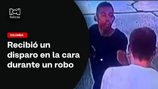 He shot him in the face when the ring he was stealing got stuck on his finger
