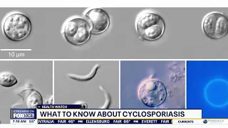 What to know about Cyclosporiasis: 42 cases in WA
