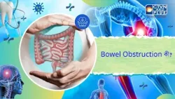 Bowel Obstruction কী। Health and Wellness