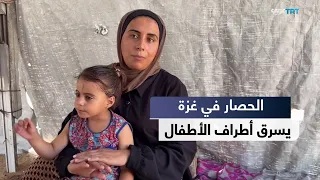 أطفال غزة بين البتر والحصار.. أطراف مفقودة وأحلام مؤجلة