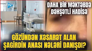 Daha bir məktəbdə DƏHŞƏT: Gözündən xəsarət alan şagirdin anası üsyan etdi