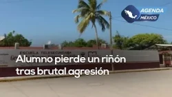 Student loses kidney after brutal beating by two classmates outside school | #AgendaMexico