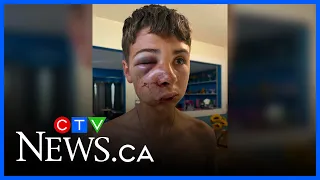 Sudbury family seeks justice after teen's skate park beating