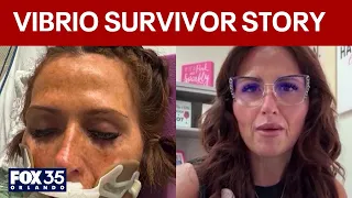 'Flesh-eating' bacteria survivor issues warning after 14 cases in Florida in 2026