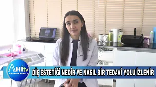 DİŞ HEKİMİ EDA ÇAM DİŞ SAĞLIĞI İÇİN HANGİ YİYECEKLER FAYDALIDIR SORUSUNU CEVAPLADI