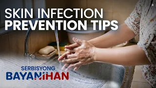 ALAMIN: Tamang first aid sa sugat at simpleng skin care routine