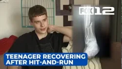 Teenager recovering after being knocked off bike, leg broken in NE Portland hit-and-run