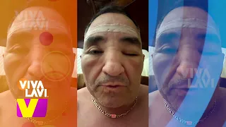 “Me dieron con todo”: Chavana aparece irreconocible | Vivalavi