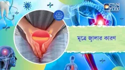মূত্রে জ্বালার কারণ। Health and Wellness