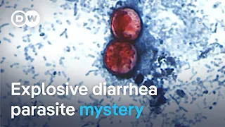 Why is the cyclospora diarrhea parasite spreading so quickly across the US? | DW News