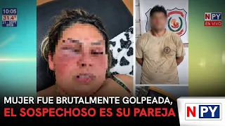 Woman brutally beaten, partner is the suspect