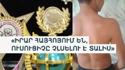 «Գողական են իրենց պատկերացնում». 12-ամյա տղան դպրոցից վնասվածքներով է տուն գալիս