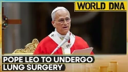 Pope Leo To Undergo Lung Surgery, Vatican Update Awaited | WION World DNA