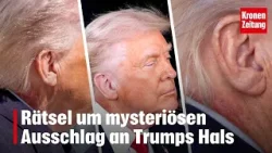 Rätsel um mysteriösen Ausschlag an Trumps Hals | krone.tv NEWS Rätsel um mysteriösen Ausschlag an Trumps Hals | krone.tv NEWS