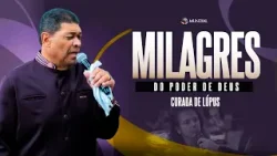 MILAGRE: CURADA DE LÚPUS MILAGRE: CURADA DE LÚPUS