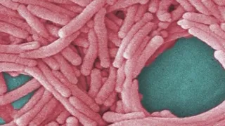 Officials work to find source of Legionnaires' cluster in Manhattan