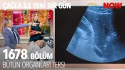Karaciğerin Olması Gereken Yerde Dalak Var - Çağla ile Yeni Bir Gün 1678. Bölüm @CaglaileYeniBirGun​