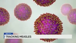 Kansas City Health Department director talks measles safety precautions
