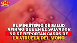 El Ministerio de Salud confirmó que en El Salvador no se reportan casos de la Viruela del Mono