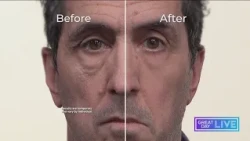 Skincare for men