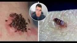 Alerta por chinche "jelepate": no mata al picar, pero puede matar años después