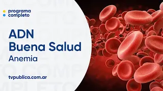 Anemia: Symptoms and Causes - ADN Buena Salud