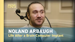 Sci-Fi Made Real: Inside the First Human Brain-Chip Trial