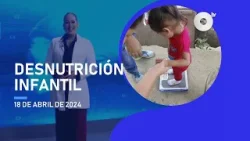 #NoticiasEcuador | Segmento de Salud: ¿La desnutrición, cuáles son sus consecuencias? 18/04/2024